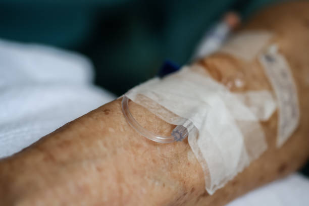 Intravenous drip of medicine at the hospital. stock photo