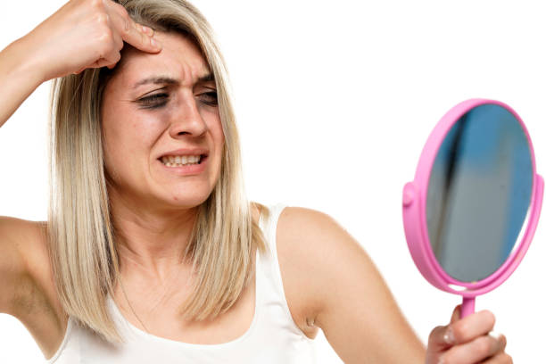 istock young woman with smudged makeup and headache 1355273252