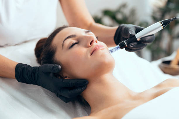 cosmetólogo realizando inyección de mesoterapia con dermapen en la cara para el rejuvenecimiento en el centro de spa. - spa treatment fotografías e imágenes de stock