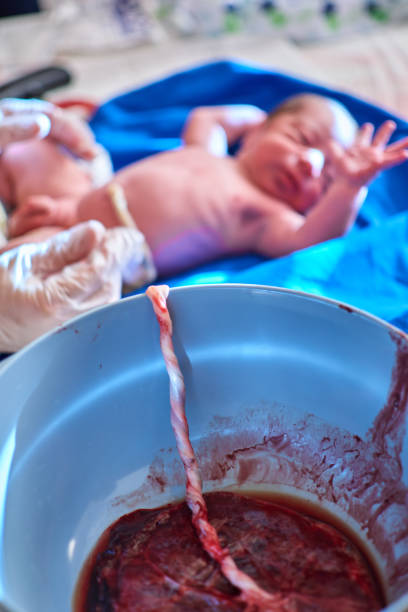 a newborn being checked by a midwife afther birth in home with its placenta