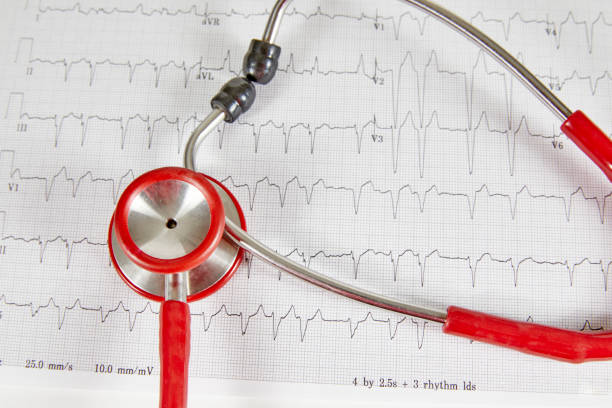 istock Abnormal Echocardiograph Report with a Red Stethoscope 1355407611