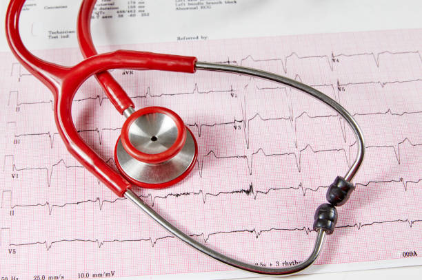 rapport d’échocardiographe anormal avec un stéthoscope rouge - valvule cardiaque photos et images de collection