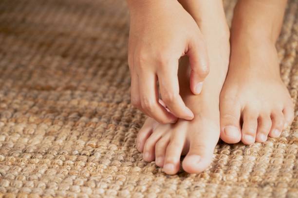 istock Wearing damp shoes and socks can cause mold and itching. 1355435805