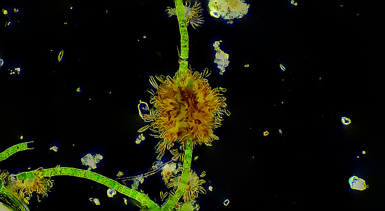 Micro organisms colony of Diatoms  on plant Algae, magnification 20x