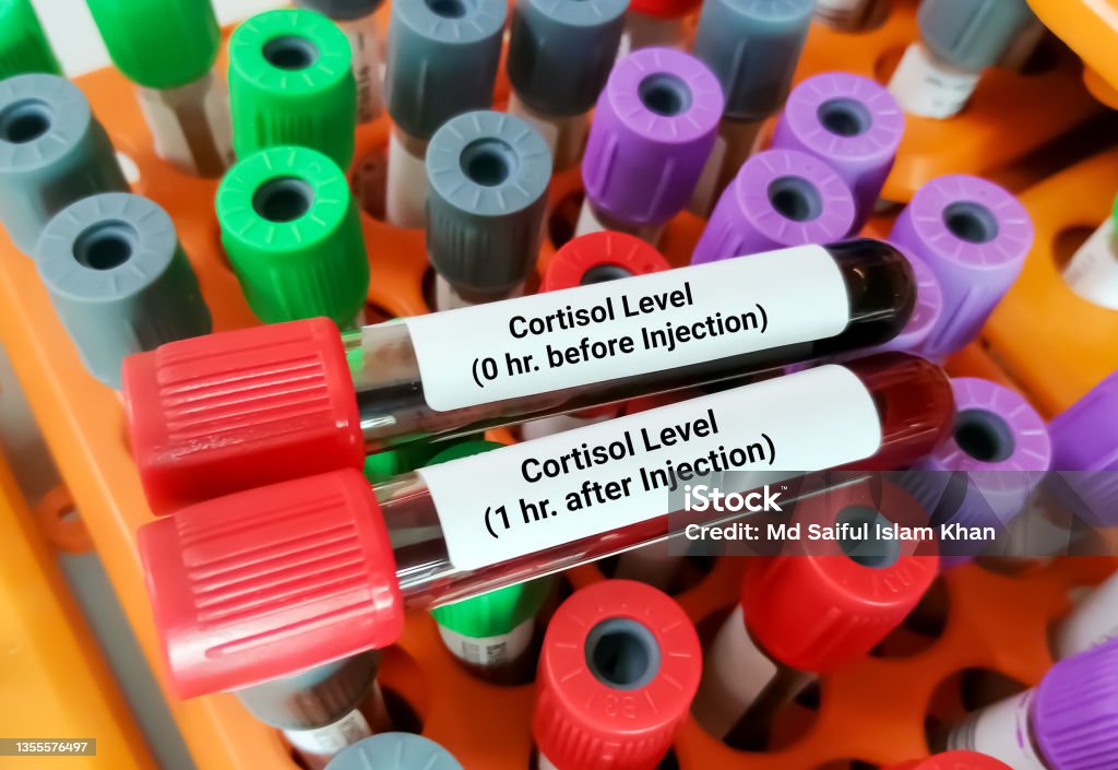 Cortsisol Collection Sample Blood Samples Isolated For Cotisol Level Stock Photo - Download Image ...