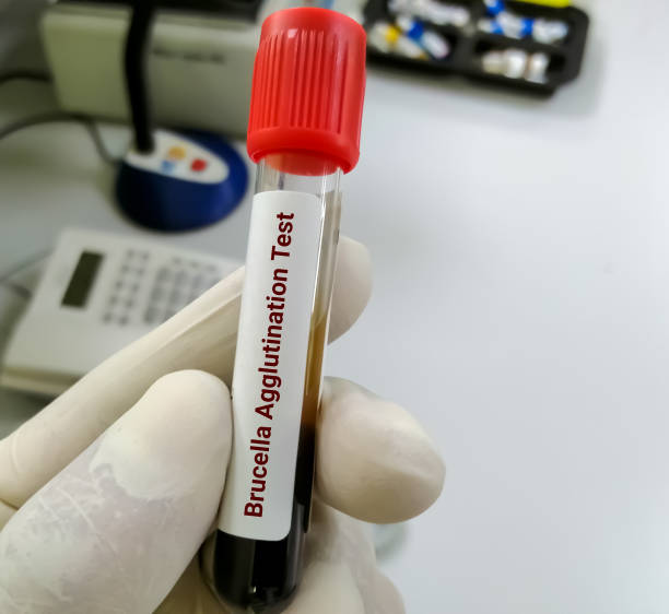 образец крови для теста на агглютинацию бруцеллы. - blood sample blood tube pathologist стоковые фото и изображения