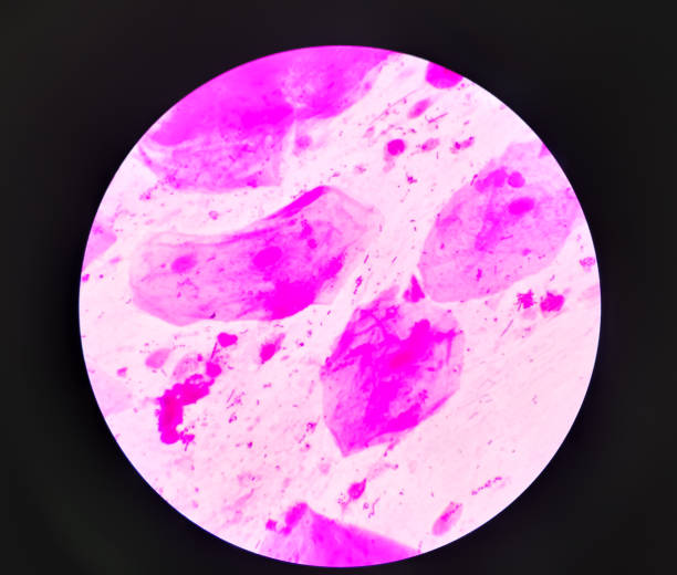 istock Prostatic smear for Gram Staining microscopic 100x show Neisseria gonorrhoeae bacteria. Gonorrhea is a sexually transmitted disease caused by Neisseria gonorrhoeae bacteria, STD prevention, treatment 1355635092