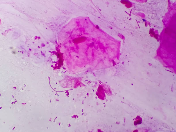 istock Neisseria Gonorrhea gram negative diplococci  microscopic image. 1355635337