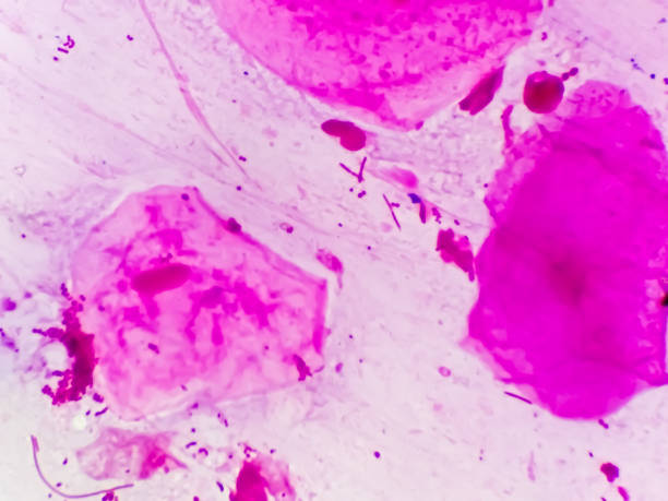 istock Neisseria Gonorrhea gram negative diplococci  microscopic image. 1355635358