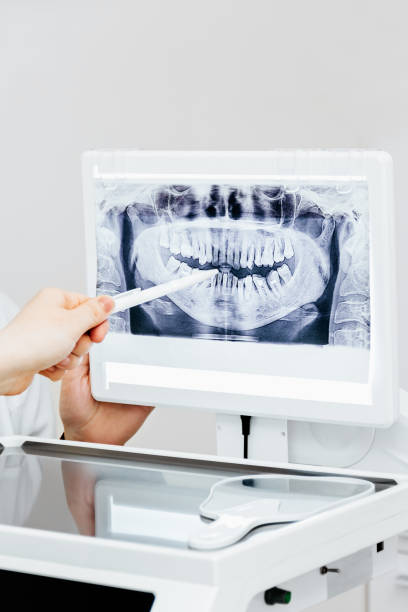 istock Dentist explaining x ray picture to patient 1355703637