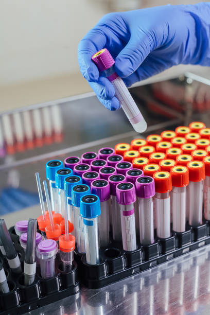 équipement de prélèvement sanguin en laboratoire pour analyse - serology photos et images de collection