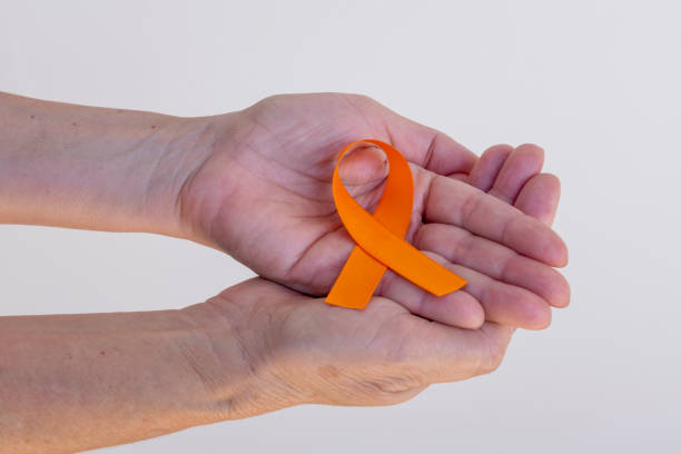 手にオレンジ色のリボン。皮膚癌、黒色腫、12月オレンジを予防するためのキャンペーン - december ストックフォトと画像