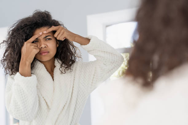 istock Young afro american woman squeeze pimple on face 1355886300