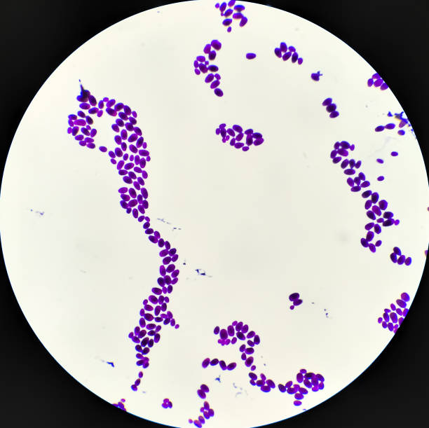 istock Branching budding yeast cells with pseudohyphae in urine gram stain fine with microscope. 1355947510