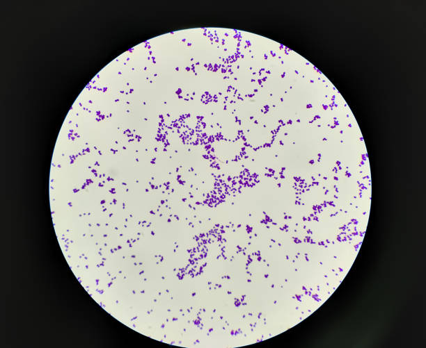 imagen microscópica teñida de gramo de colonia de staphylococcus aureus. - mrsa bacterium streptococcus staphylococcus fotografías e imágenes de stock