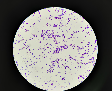 Staphylococcus aureus colony gram stained microscopic image.