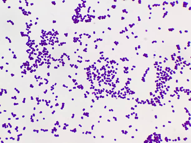 황색 포도상 구균 식민지 그램 염색 된 현미경 이미지. - staphylococcus aureus 뉴스 사진 이미지