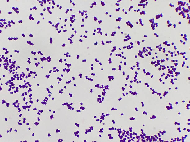 staphylococcus aureus colonie gram image microscopique colorée. - mrsa bacterium colony microbiology photos et images de collection