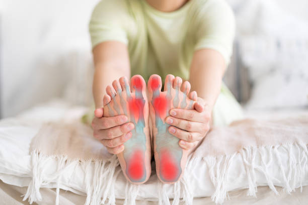 Joint diseases, hallux valgus, plantar fasciitis, heel spur, woman's leg hurts, pain in the foot, massage of female feet at home stock photo