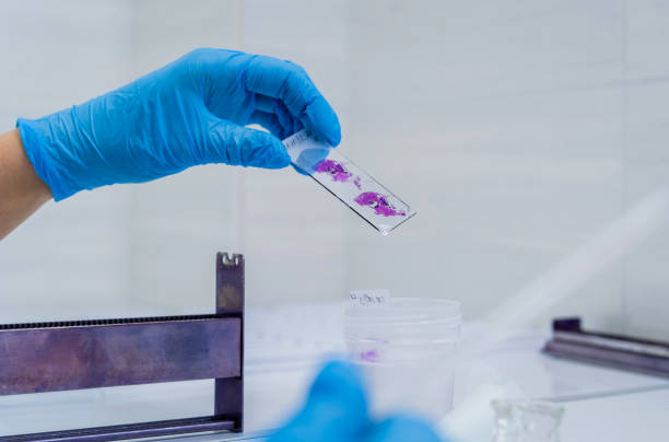 istock Hands in blue glove holding glass histology slides 1356011508