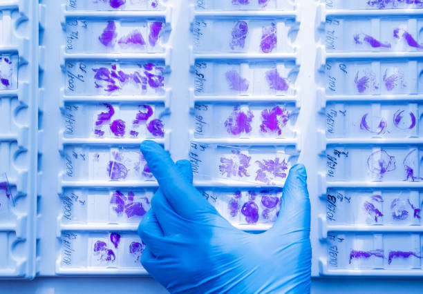 hand in blauem handschuh mit glas histologie-objektträgern - biopsie stock-fotos und bilder
