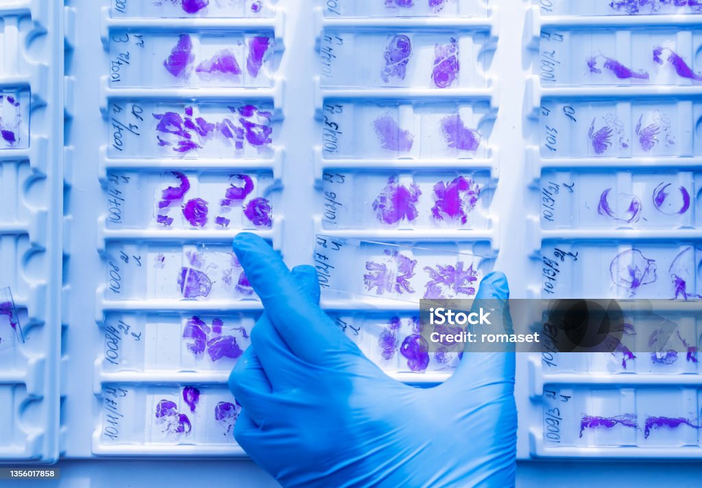 Hand in blue glove holding glass histology slides Hand in blue glove holding glass histology slides. Histology Stock Photo
