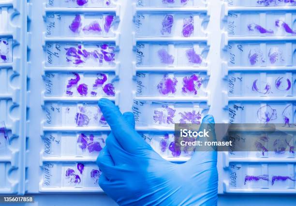 Hand In Blue Glove Holding Glass Histology Slides Stock Photo - Download Image Now - Histology, Sliding, Biopsy
