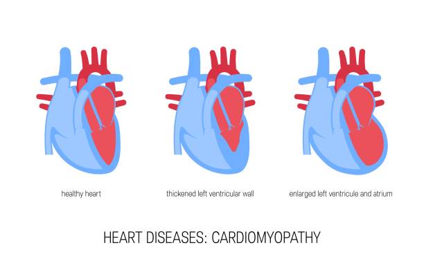 herzkrankheitskonzept im flachen stil, vektor - human heart heart disease healthy lifestyle human internal organ stock-grafiken, -clipart, -cartoons und -symbole