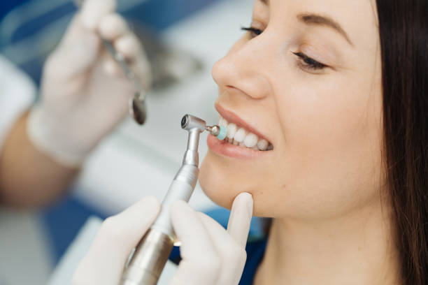 igiene orale, dentista che esegue la procedura di ridimensionamento e spazzolatura - igienista dentale foto e immagini stock