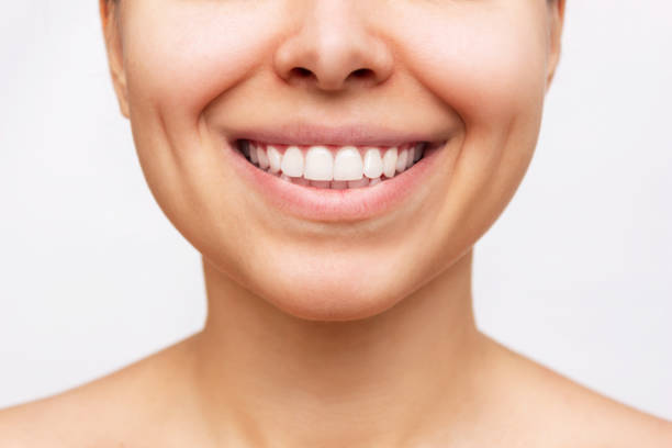 完璧な白い歯を持つ若い女性のクロップドショット。美しい笑顔のクローズアップ。歯科学 - half smile ストックフォトと画像