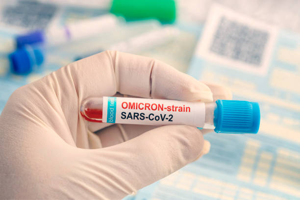 médico con una muestra de sangre positiva para la nueva variante detectada de la cepa del coronavirus llamada covid omicron. investigación de nuevas cepas africanas y mutaciones del coronavirus covid 19 en el laboratorio - omicron fotografías e imágenes de stock