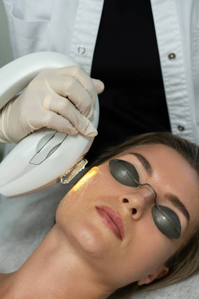 Woman client during IPL treatment in a cosmetology clinic Woman client during IPL treatment in a cosmetology medical clinic medical laser photos stock pictures, royalty-free photos & images