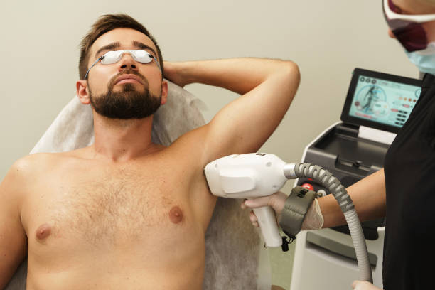 Man during photoepilation procedure in aesthetic medical clinic Man during IPL photo epilation procedure in aesthetic medical clinic body hair stock pictures, royalty-free photos & images