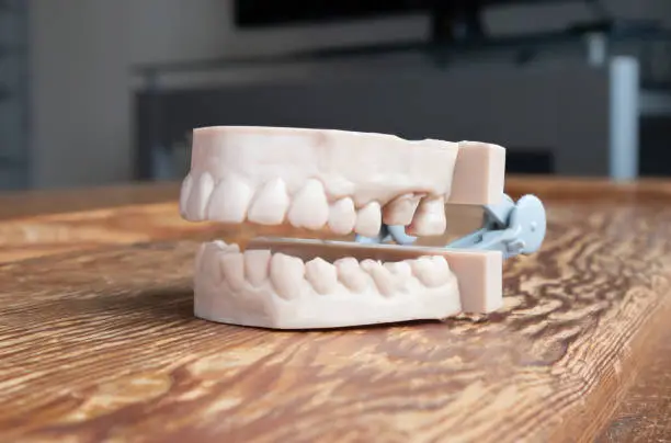 Upper and lower jaw of adult. Used to create aligners, night guards, braces, crowns, dentures and surgical guides.  The 3D printed teeth model is on a wood table.