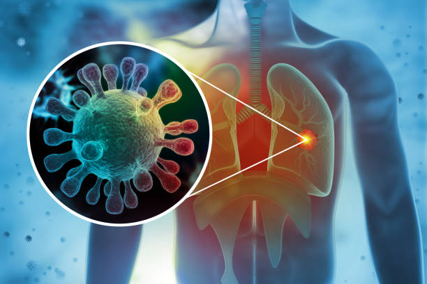 istock Virus or bacteria infecting respiratory system.3d illustration 1356329849