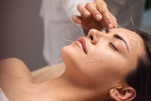 Acupuncture specialist inserting needle into patient's face due treatment. She is stimulating energy flow through the body for faster relaxation and recovery.