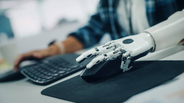 Inclusive Office: Person with Disability Using Prosthetic Arm to Work on Computer. Professional with Advanced Myoelectric Bionic Limb to Control Mouse. Shot with Focus on Hands with Dutch Angle oficina inclusiva: persona con discapacidad que usa el brazo protésico para trabajar en la computadora. profesional con extremidad biónica mioeléctrica avanzada para controlar el ratón. disparo con enfoque en las manos con ángulo holandés