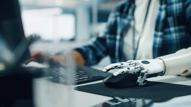 istock Diverse Body Positive Office: Woman with Disability Using Prosthetic Arm to Work on Computer. Professional with Futuristic Thought Controlled Myoelectric Bionic Hand. 1356364209