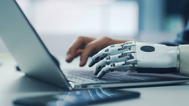istock Close-up on Hands: Person with Disability Using Prosthetic Arm to Work on Laptop Computer. Specialist Swift and Natural Use of Thought Controlled Body Powered Myoelectric Bionic Hand. 1356364243