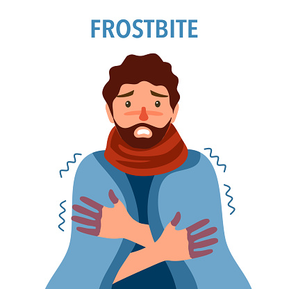 Man suffering from frostbite. Guy with frozen hands in winter season in flat design. Skin burn symptom.