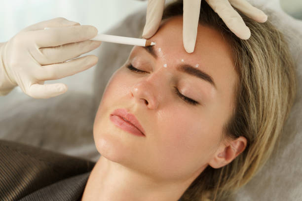 doctor making marks on client's face before filler injection - human hand pencil women sketching imagens e fotografias de stock