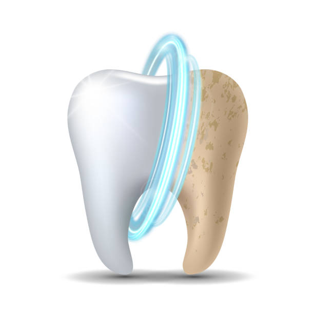 illustrazioni stock, clip art, cartoni animati e icone di tendenza di denti puliti e sporchi prima e dopo lo sbiancamento - sbiancamento dentale