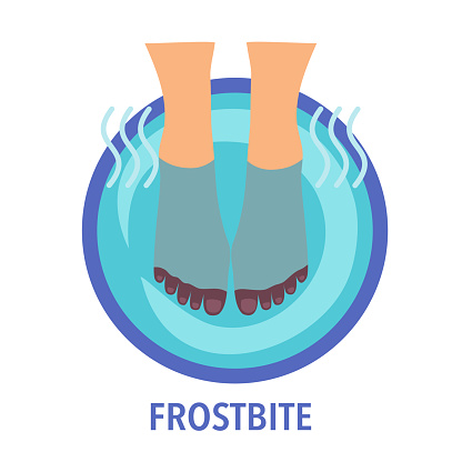 Soaking feet in bowl filled with warm water in flat design. Warming feet for relief pain and burning skin vector illustration on white background. Toes frostbite treatment.