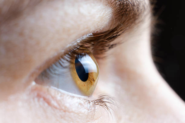 makro zdjęcie ludzkiego oka z chorobą rogówki stożkowato-rogówki - grafted zdjęcia i obrazy z banku zdjęć