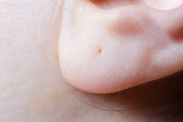 A close-up of the human earlobe. Macro photo of a pierced ear in a woman. Earlobe stock pictures, royalty-free photos & images