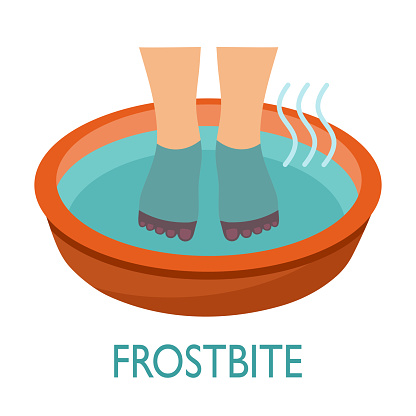 Title: Soaking feet in bowl filled with warm water in flat design. Warming feet for relief pain and burning skin vector illustration on white background. Toes frostbite treatment.