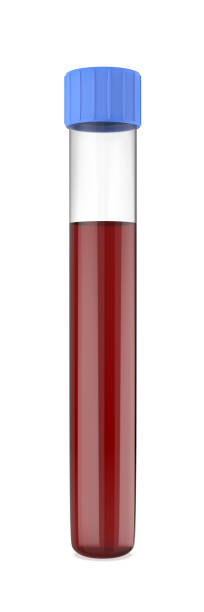 Test tube with blood stock photo