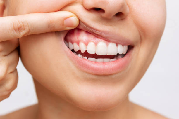 gum health. cropped shot of a young woman showing healthy gums - gums imagens e fotografias de stock