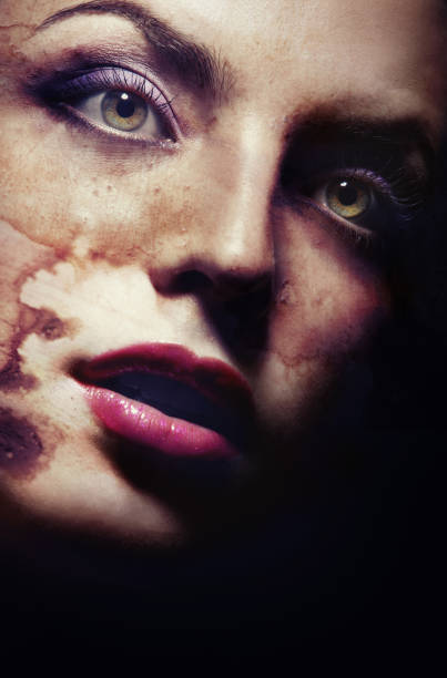 Female vampire with skin damaged by sunburn