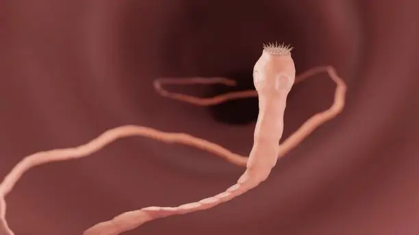 Tapeworm in intestine